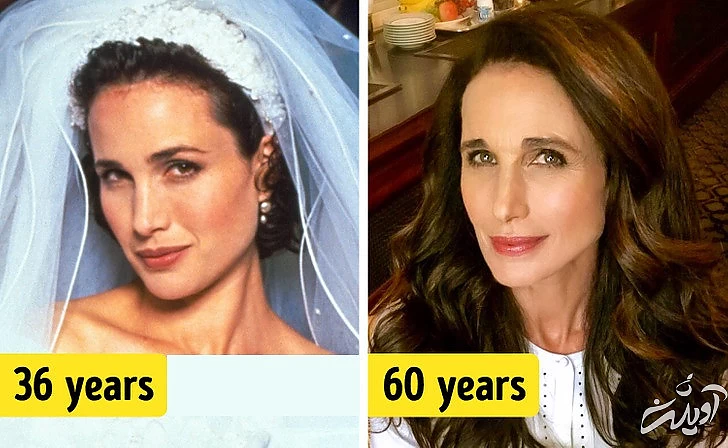 چهرههای معروفی که هیچ جراحی زیبایی نکردهاند